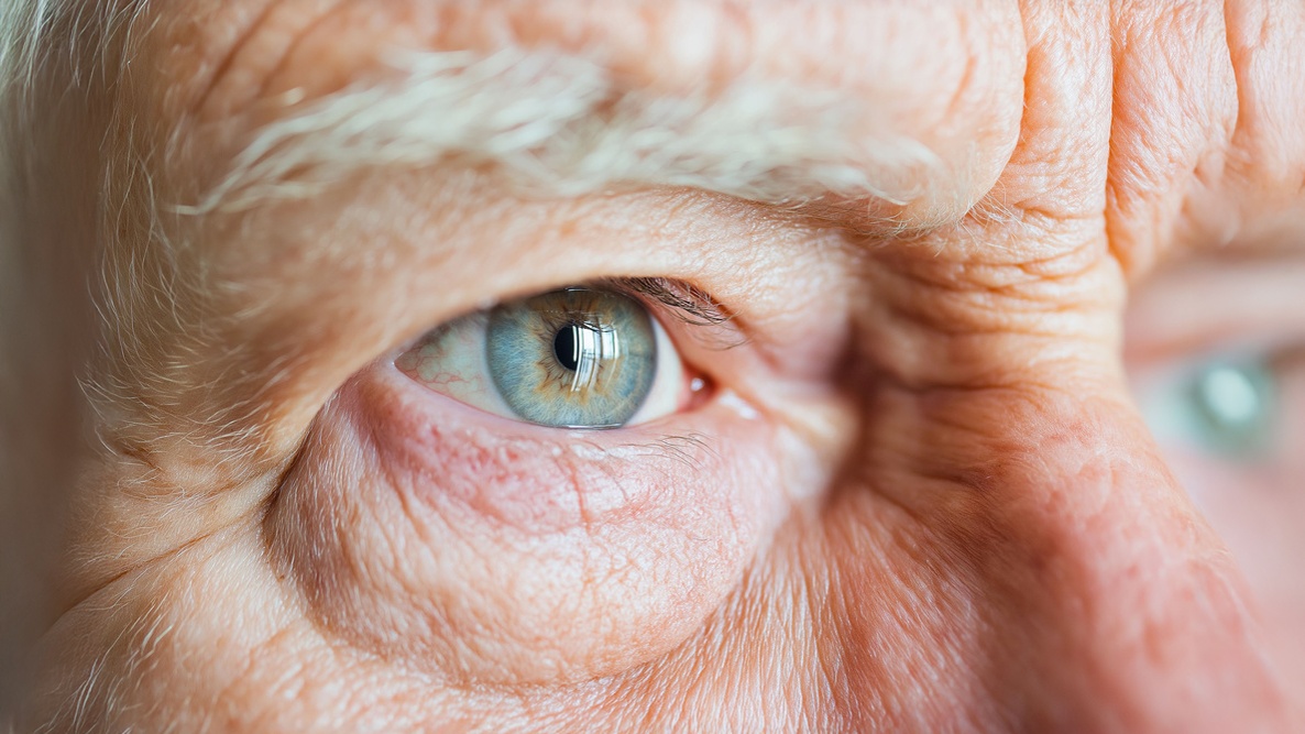 levofloxacino catarata