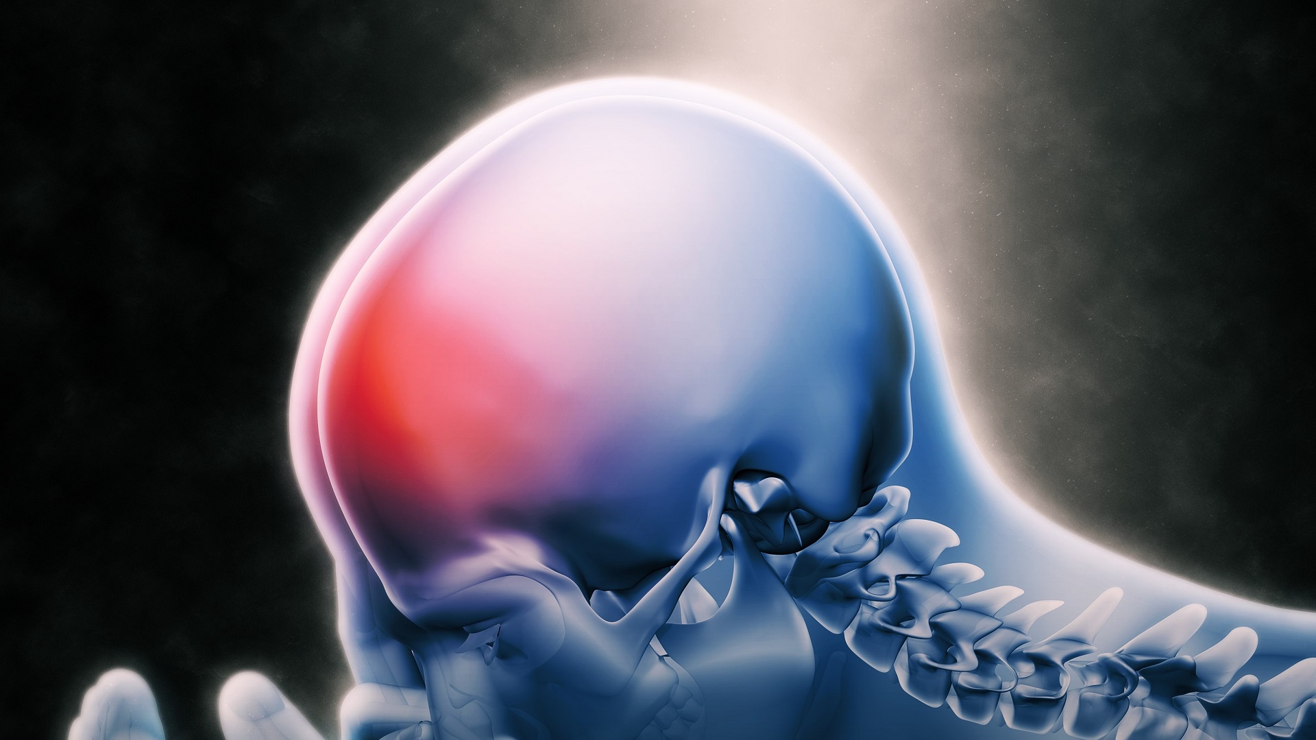 Hipertensão intracraniana idiopática: Topiramato ou acetazolamida? 
