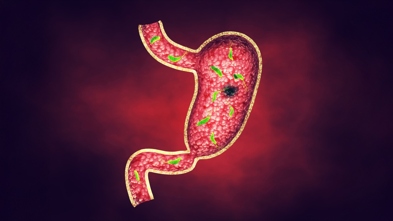 Tratamento do H. pylori em crianças
