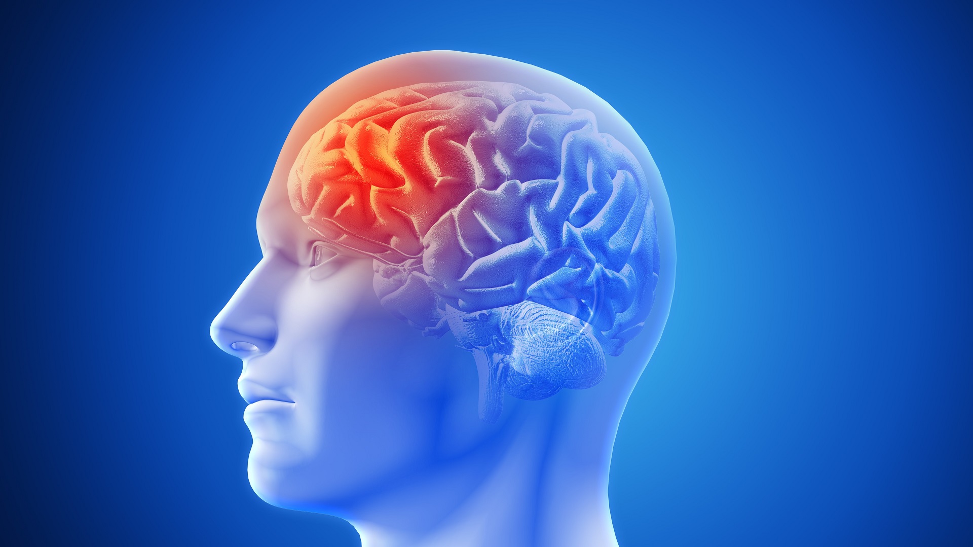 Sequelas neurológicas pós encefalite por dengue 