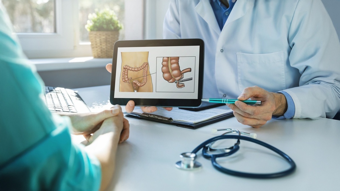 infecção cirúrgica em apendicectomia