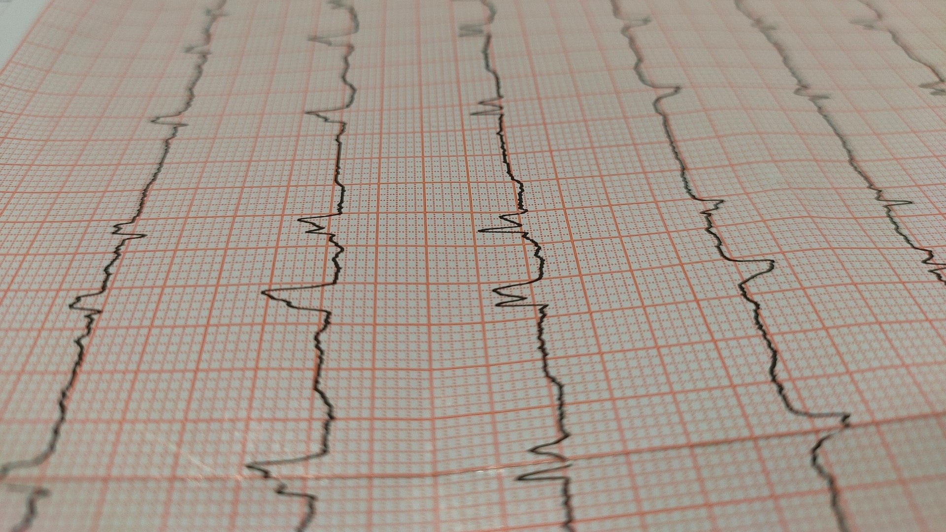 Quais foram as principais diretrizes de cardiologia em 2025? 