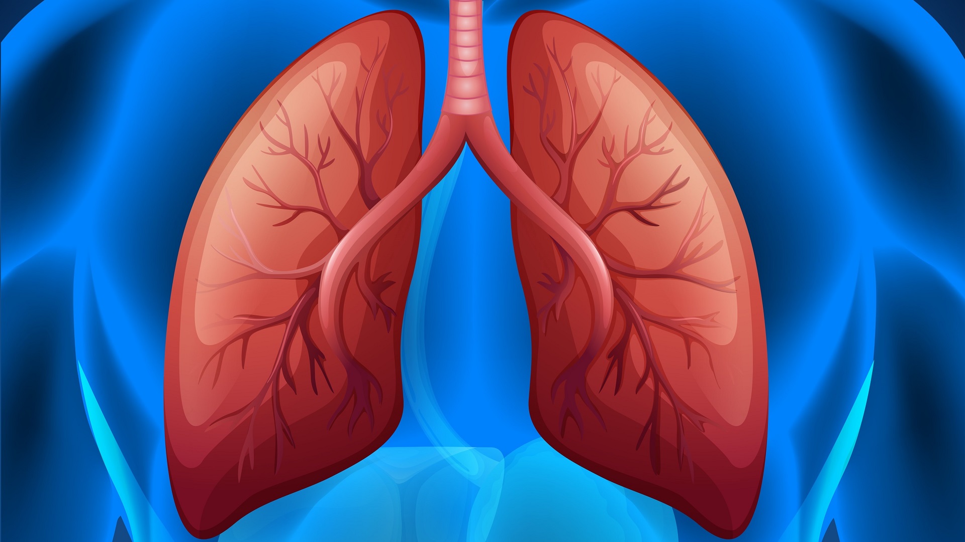 Doença pulmonar por M. avium complex: tempo de conversão e prognóstico 