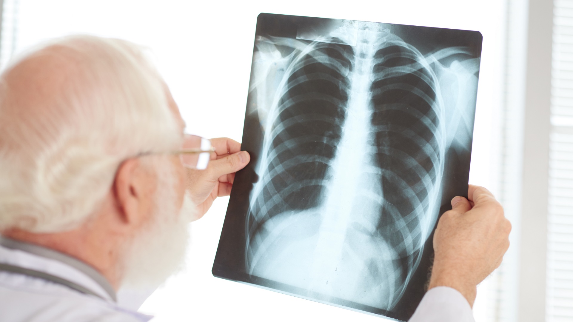 Pneumonia comunitária grave e pneumonia adquirida no hospital: O que saber?