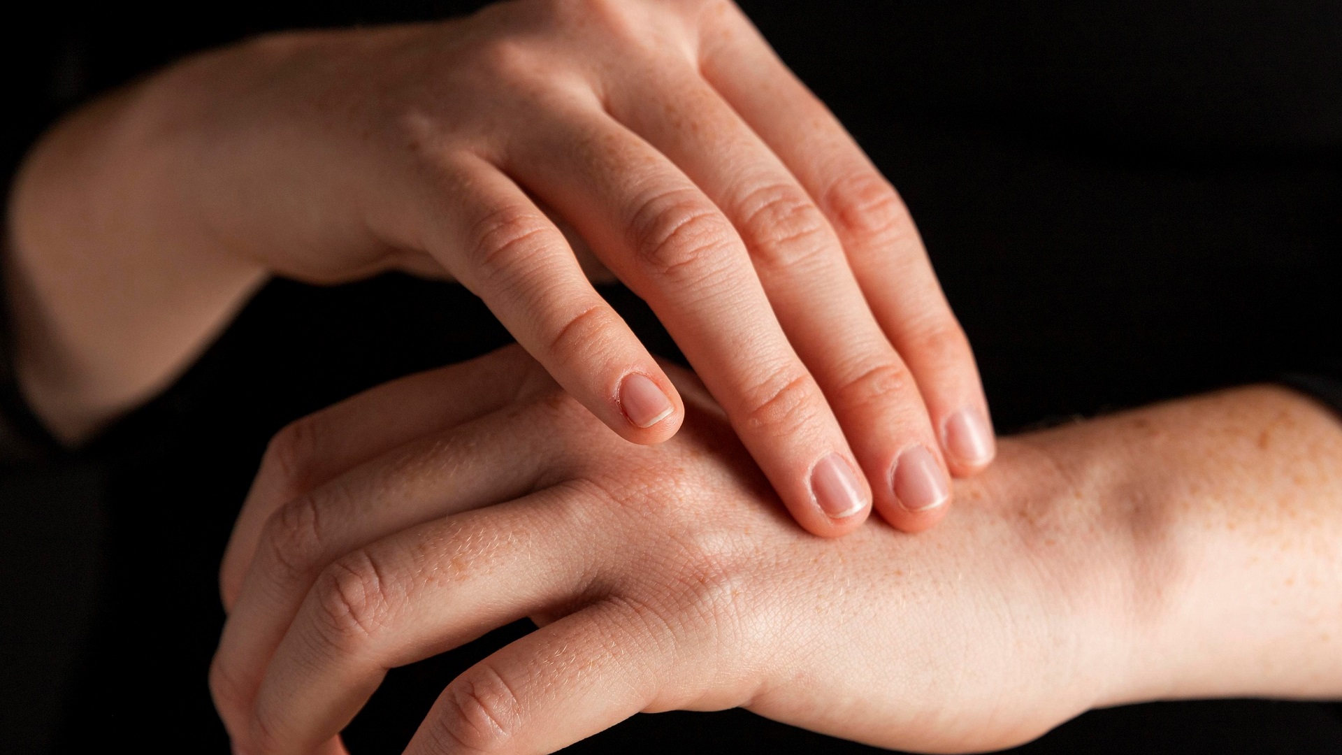 Pustulose palmoplantar: Qual a influência das diferenças étnicas nesta dermatose? 