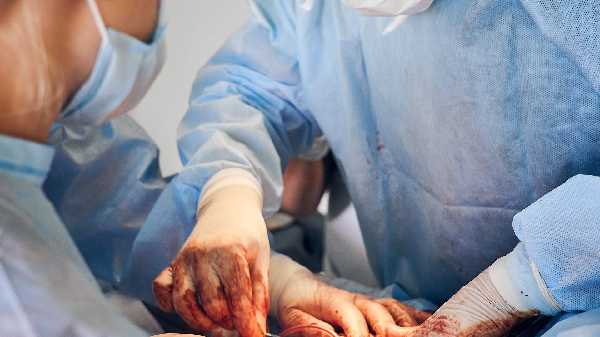 A azatioprina e o risco de câncer de pele não melanoma entre transplantados 