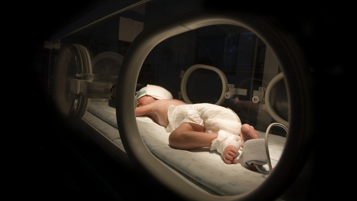 SUS tecnologia para avaliar prematuridade