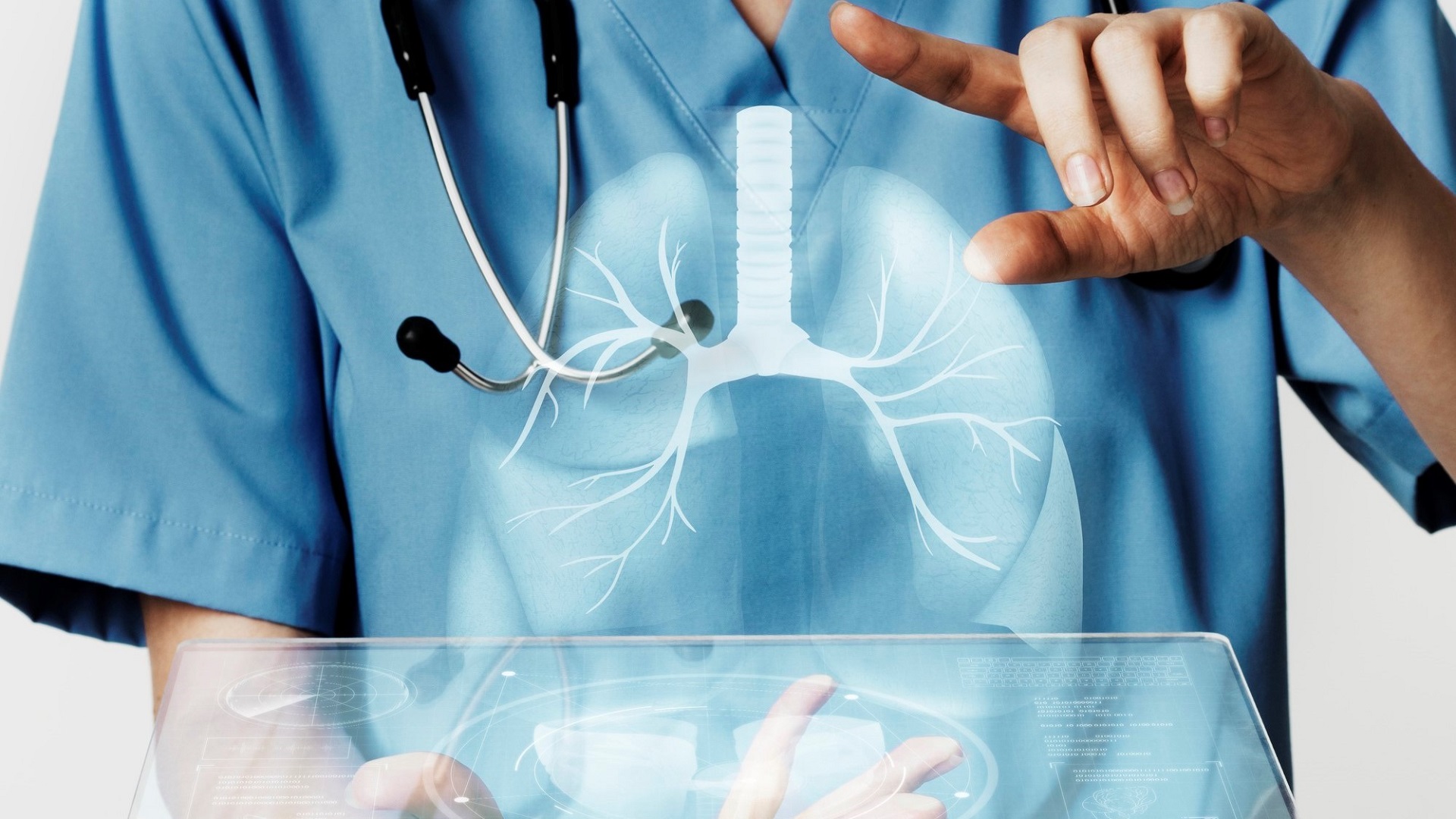 Casos de Influenza A crescem e aumentam números de SRAG no país