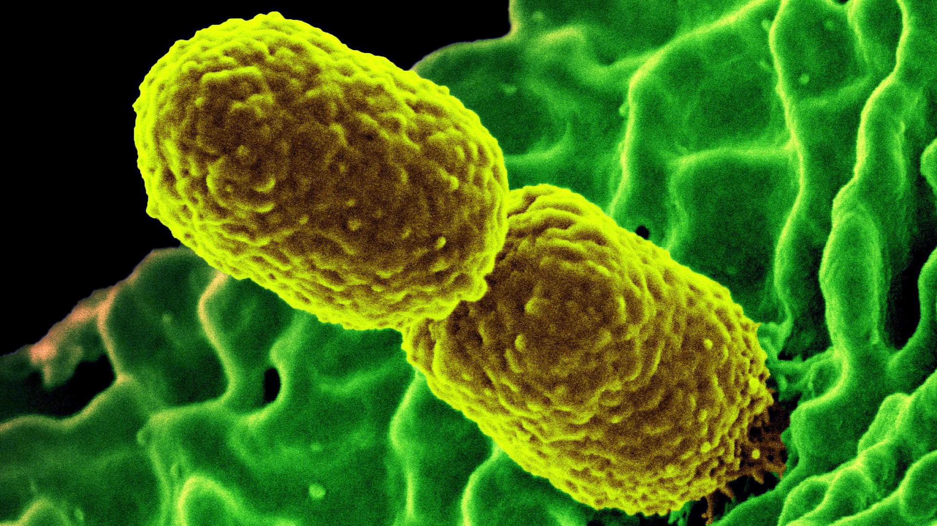 KPC: o que precisamos saber?