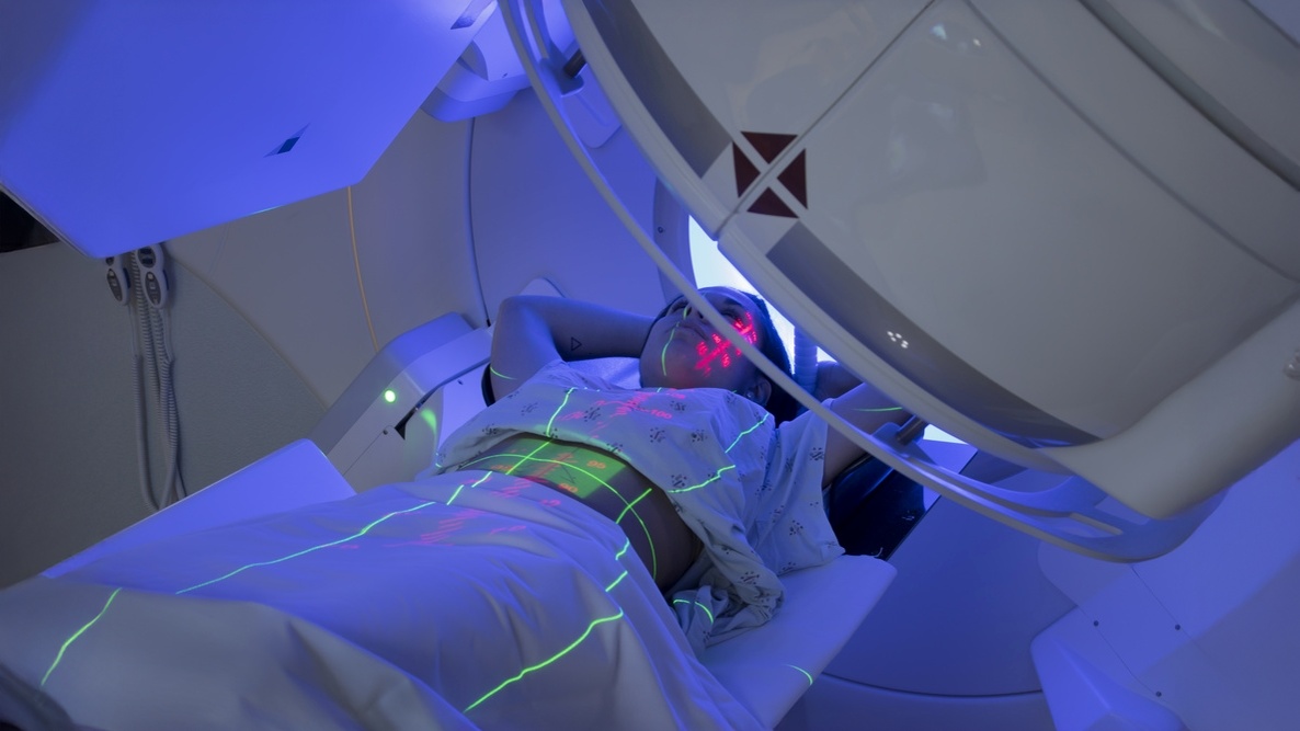 radioterapia em pacientes sob inibidores de egfr