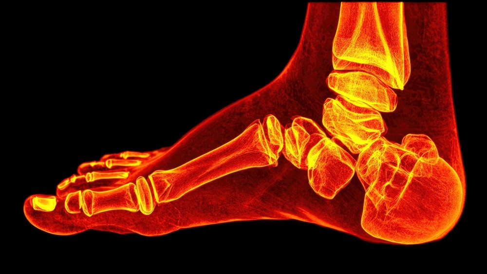 cirurgia fraturas escafoide