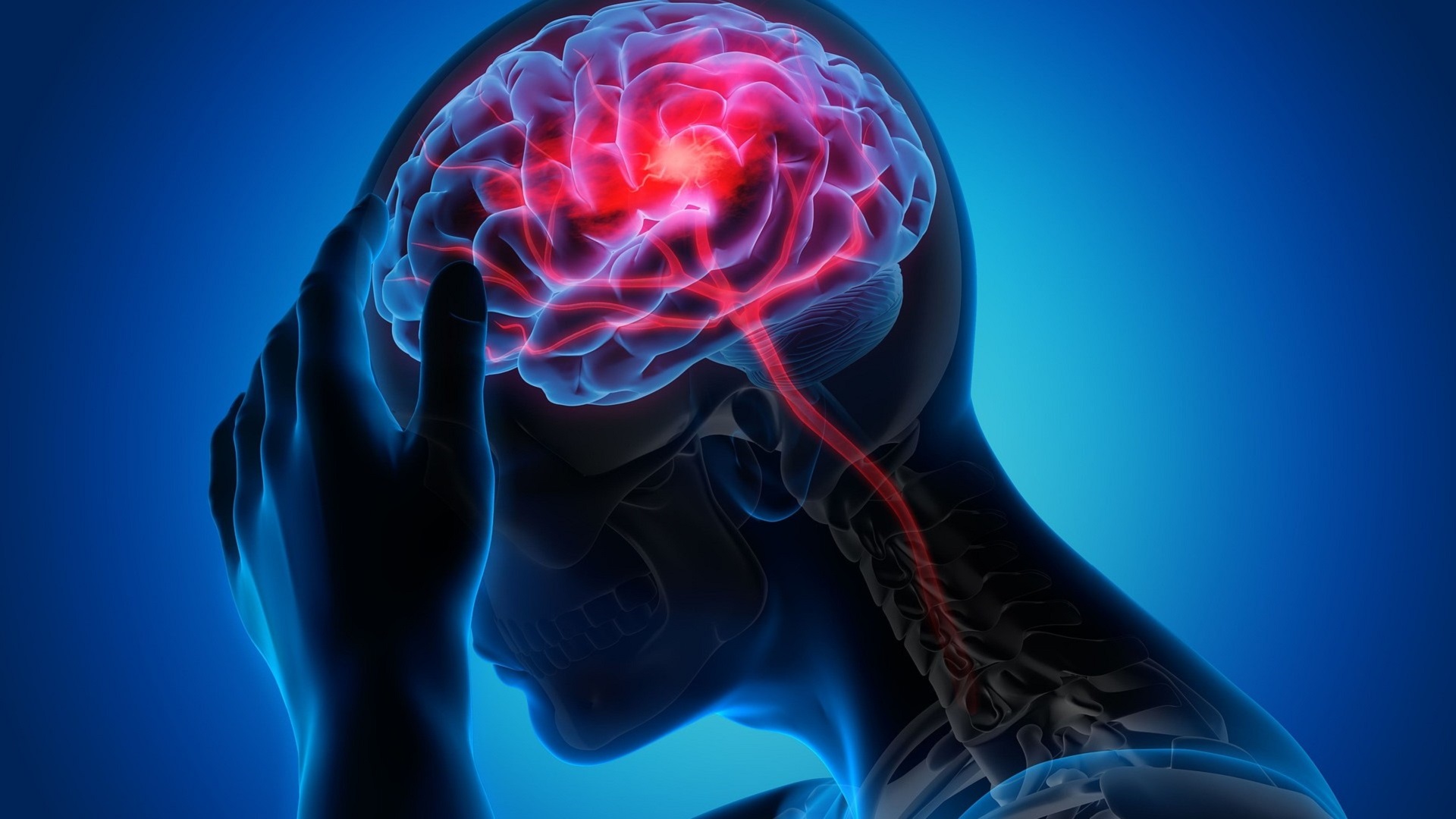 AAN 2026: Urgências em cefaleia, sinais de alarme e manejo do status migranoso