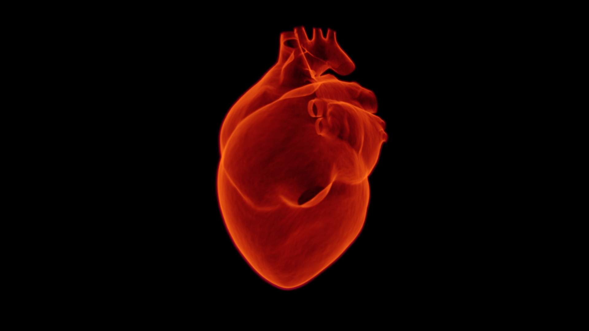 Amiloidose cardíaca: Anvisa aprova nova terapia para cardiomiopatia por TTR