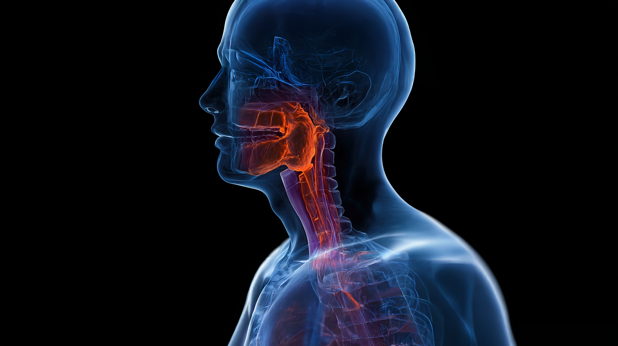 quimioterapia câncer de cabeça e pescoço