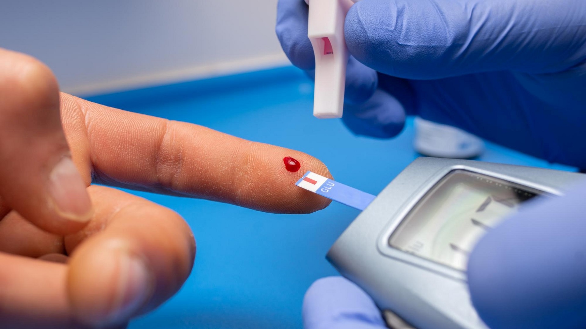 Teplizumabe para diabetes tipo 1: FDA aprova nova indicação para a doença