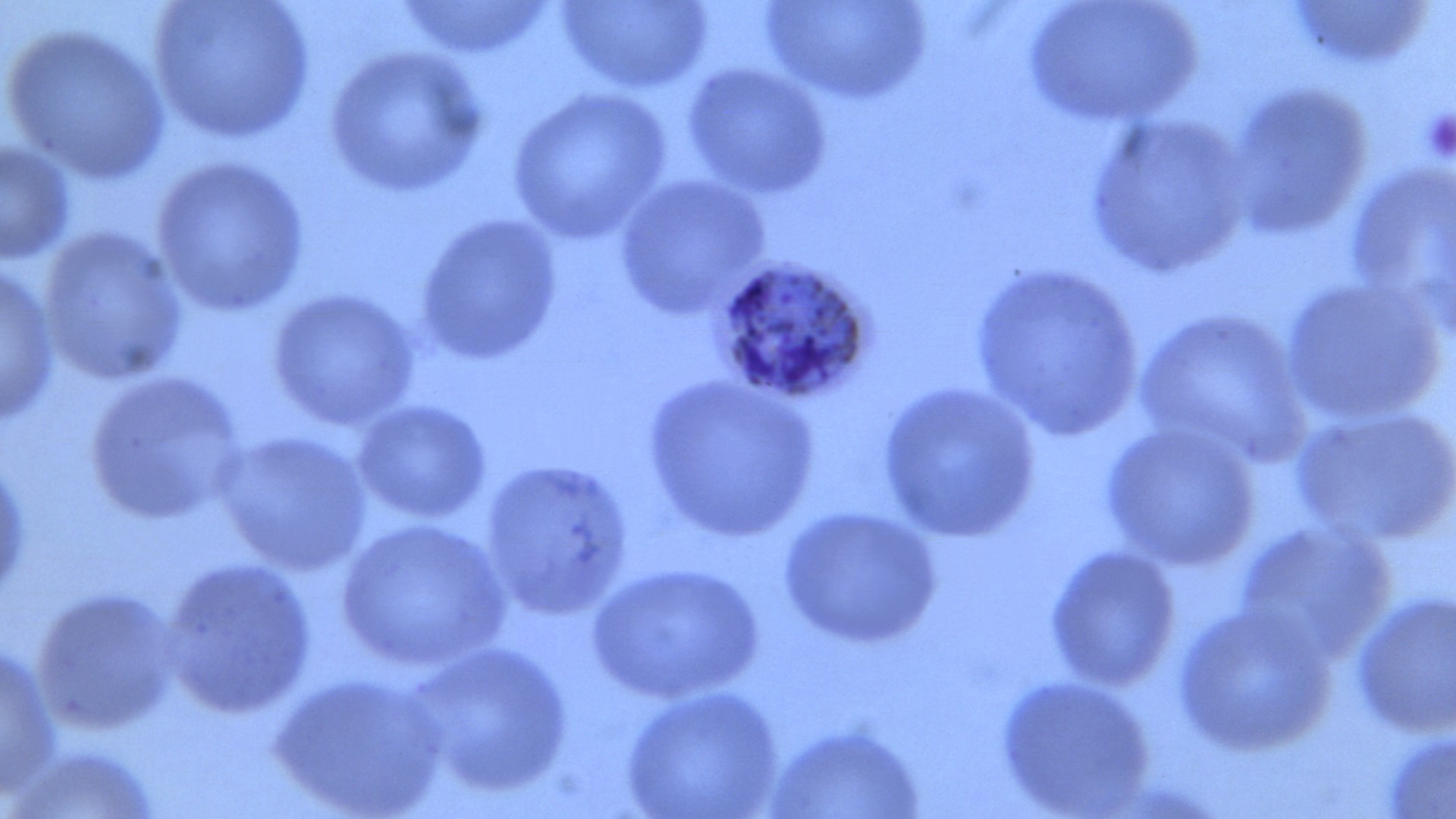 Novo estudo identifica potencial para vacina universal contra malária