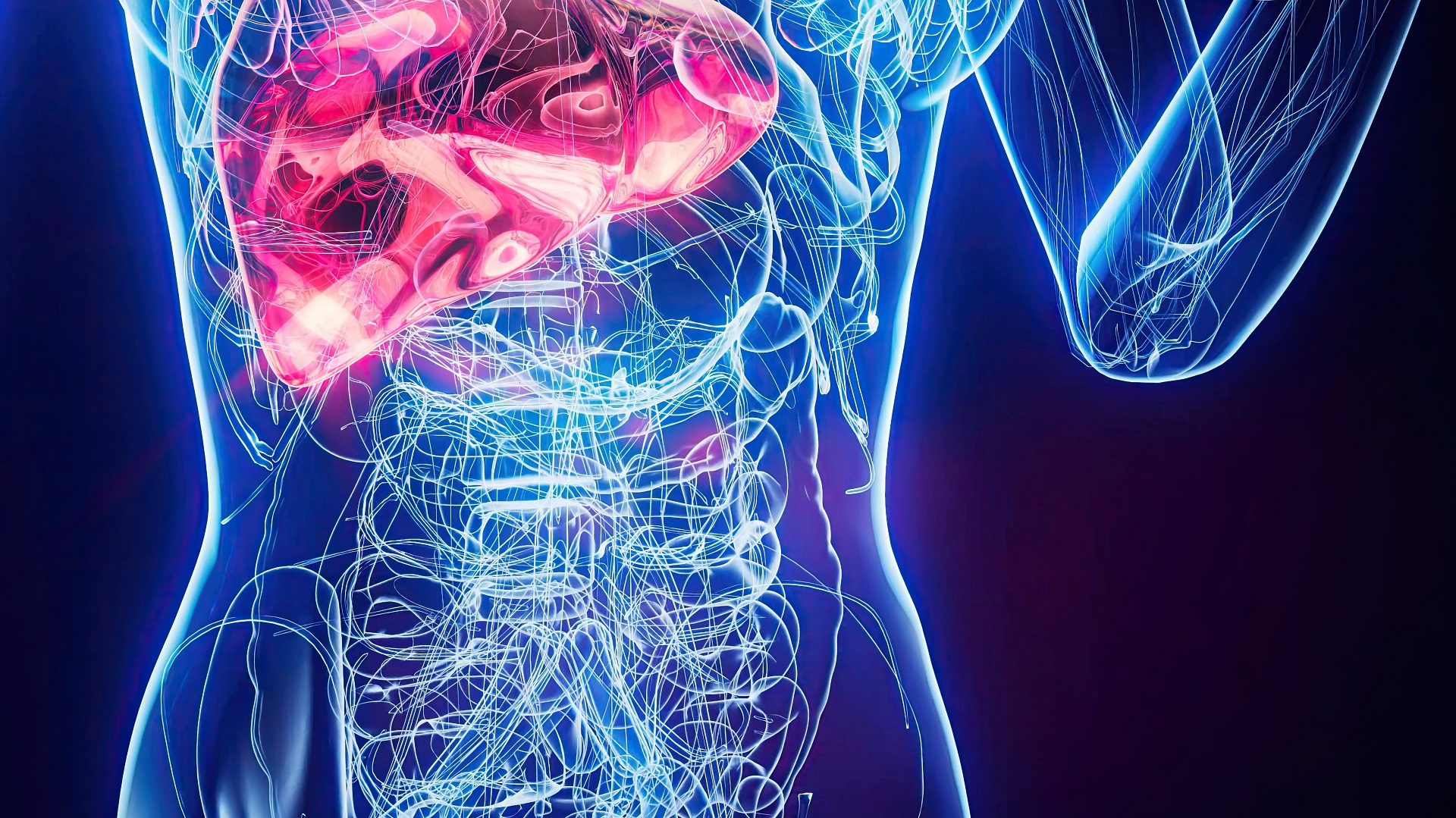 Dinâmica de progressão da esteatose hepática para cirrose e suas complicações