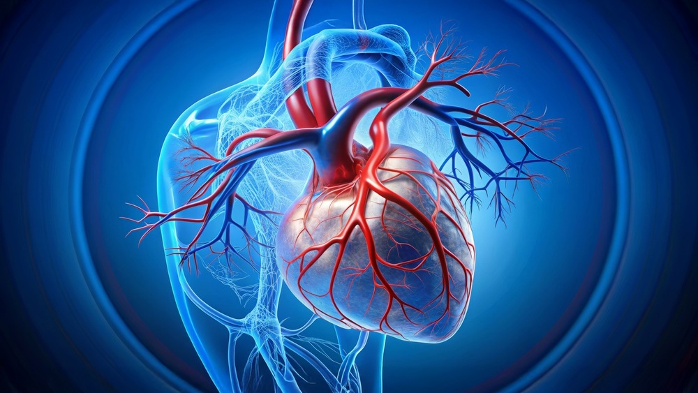 angioplastia
