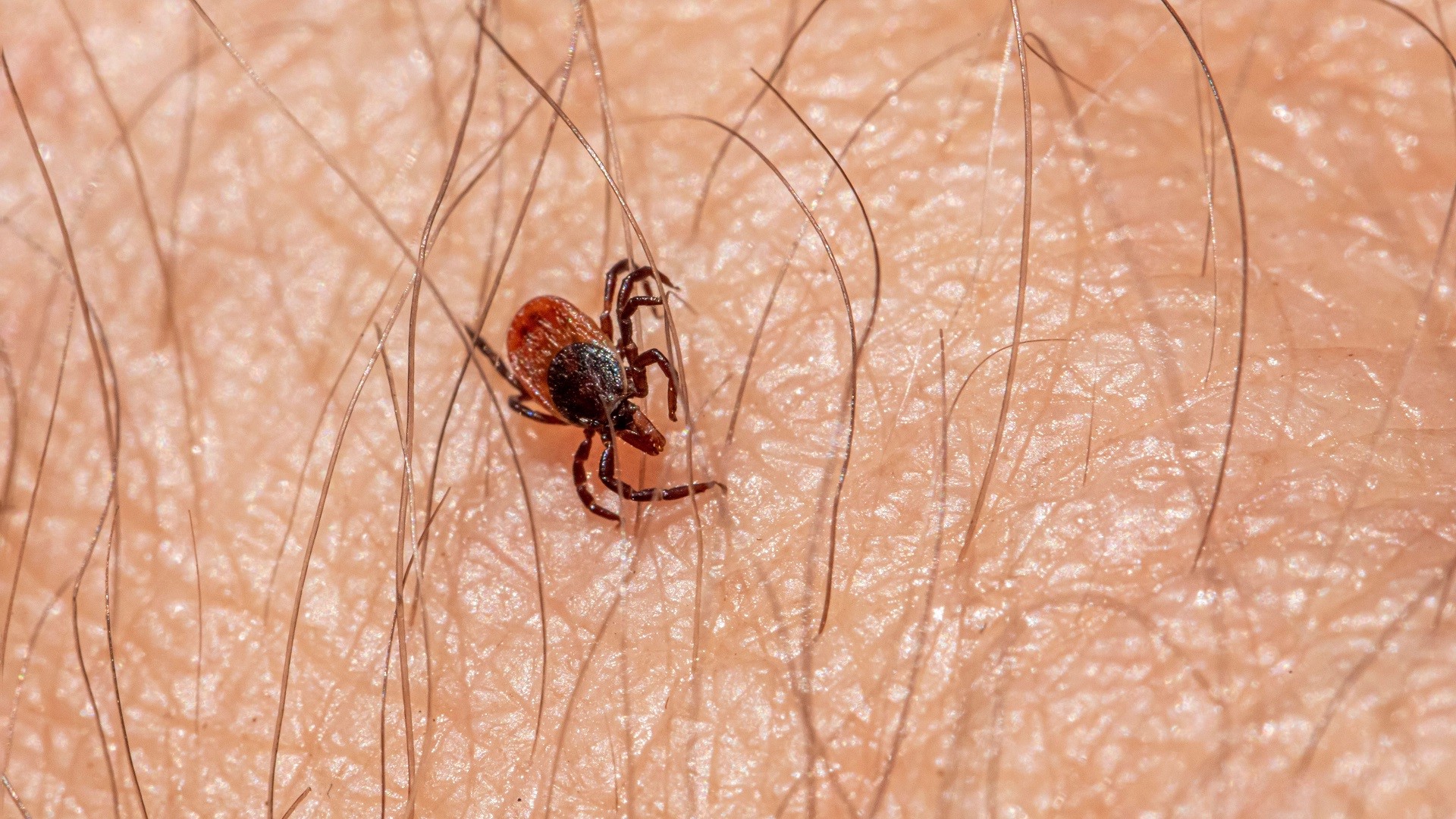 Avanço da febre maculosa no Brasil acende alerta para diagnóstico precoce