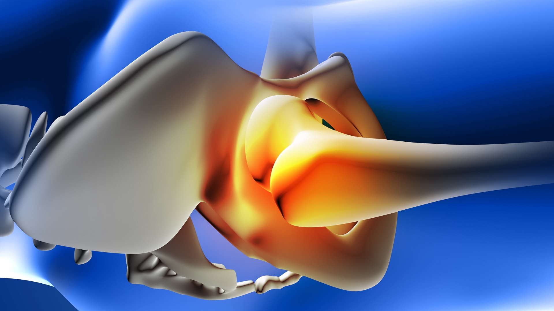ATQ de dupla mobilidade ou hemiartroplastia para fraturas do colo do fêmur?