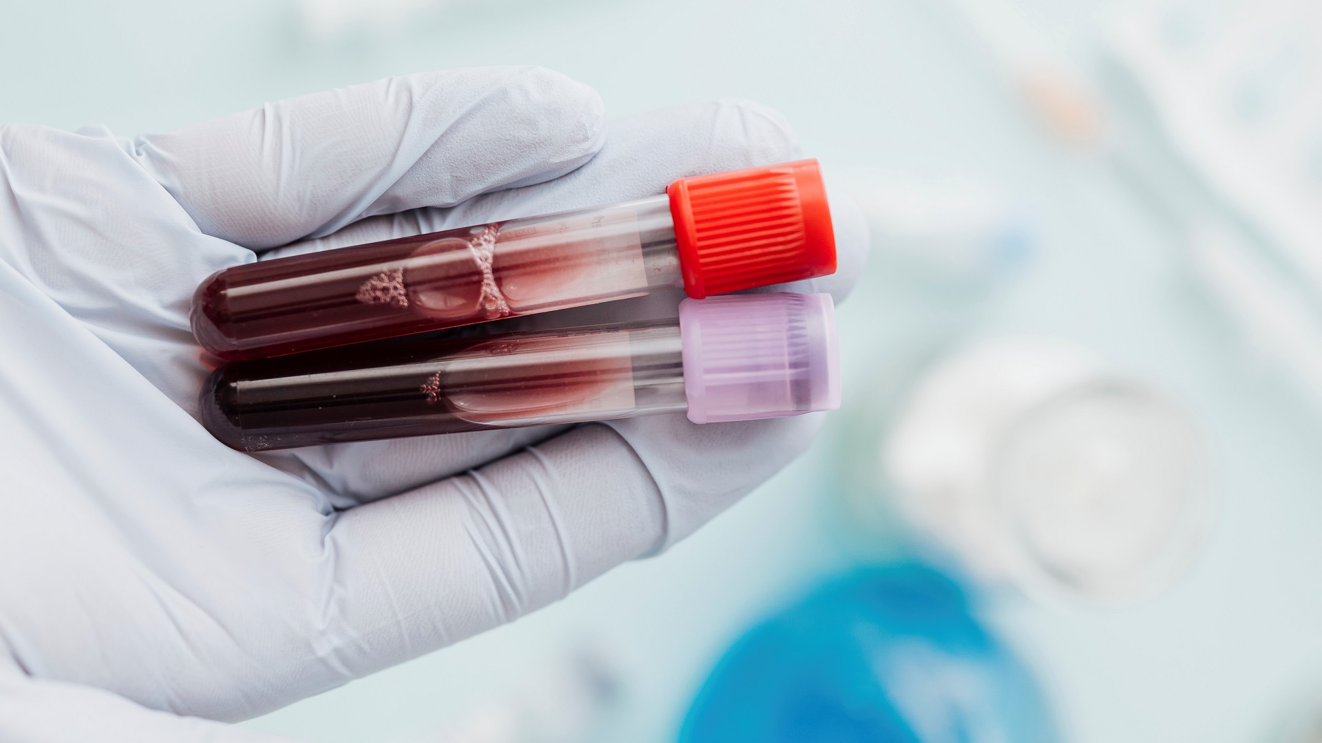 Sangue coletado por dispositivo robótico
