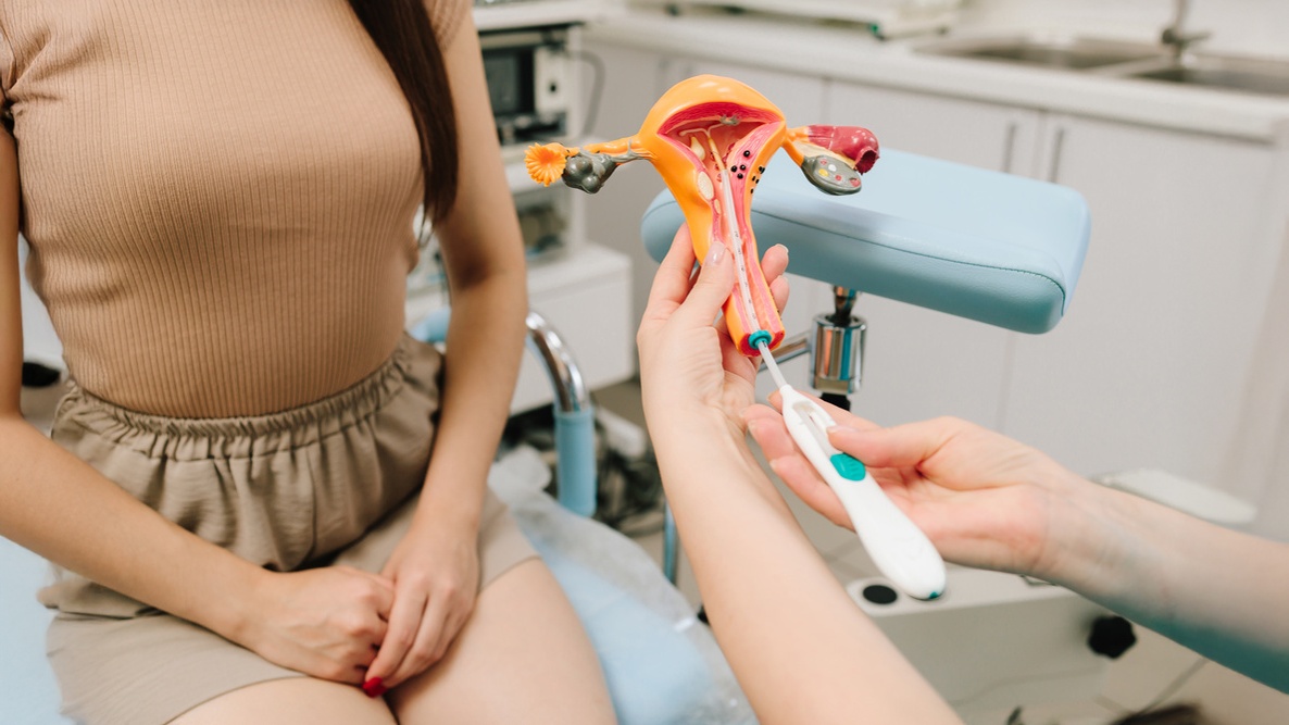 Profissional da saúde demonstrando inserção do DIU hormonal em protótipo e mulher aguardando atendimento