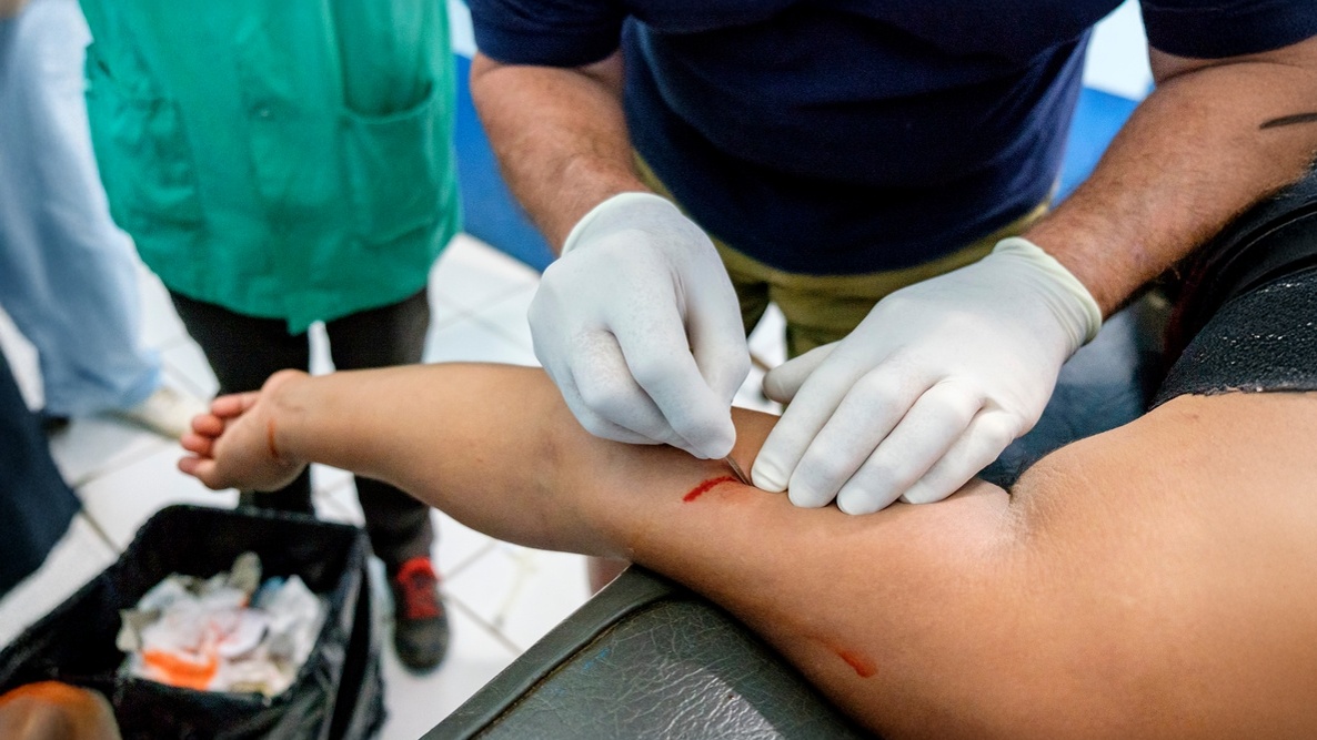 Profissional de saúde retira implante de etonogestrel em paciente