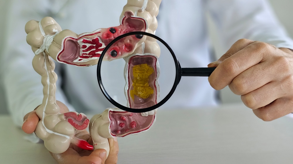 Profissional de saúde destaca cólon com uma lupa em protótipo do trato gastrointestinal