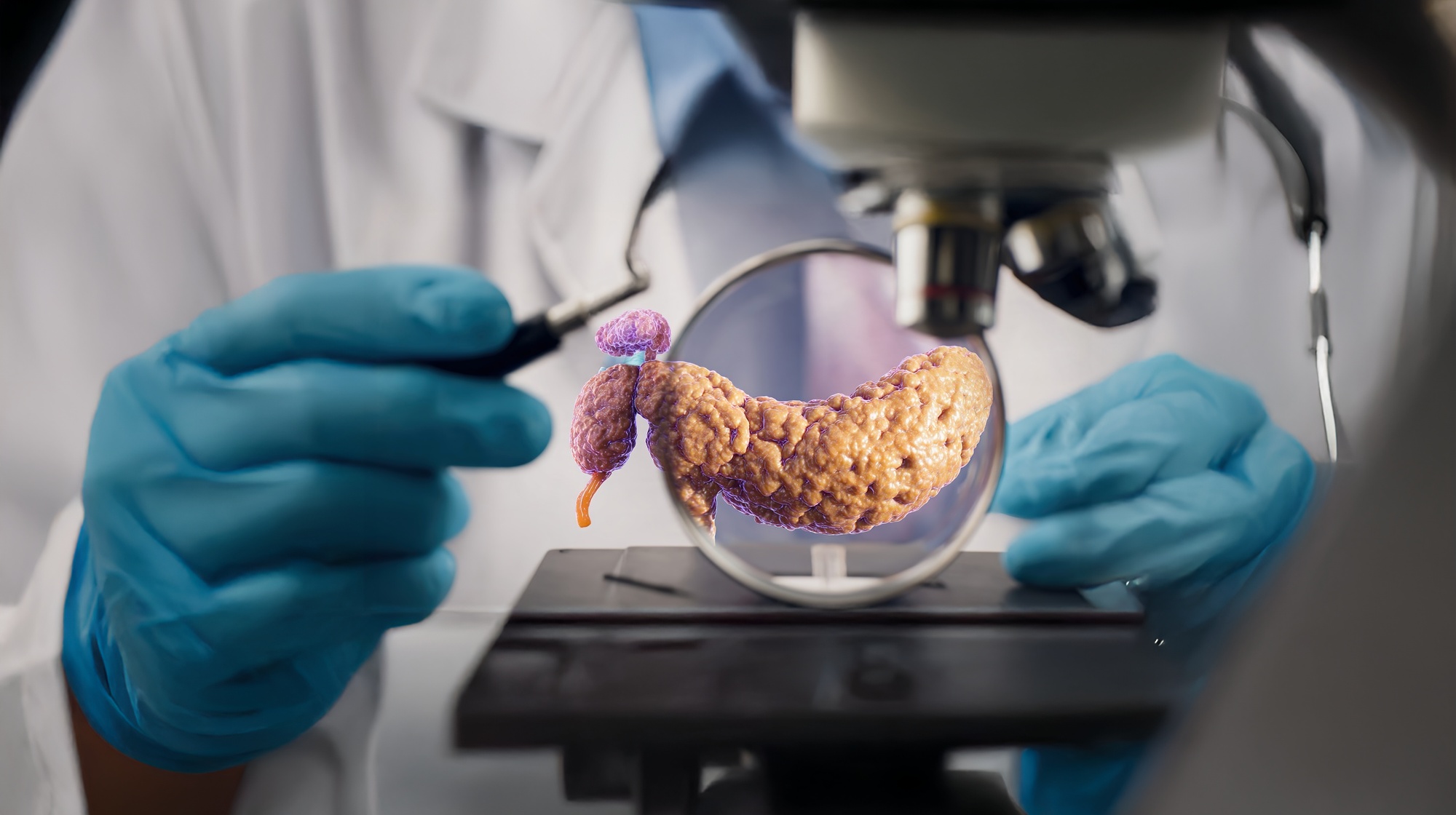 Profissional de saúde observa ilustrativamente projeção de pâncreas no microscópio em alusão ao câncer de pâncreas