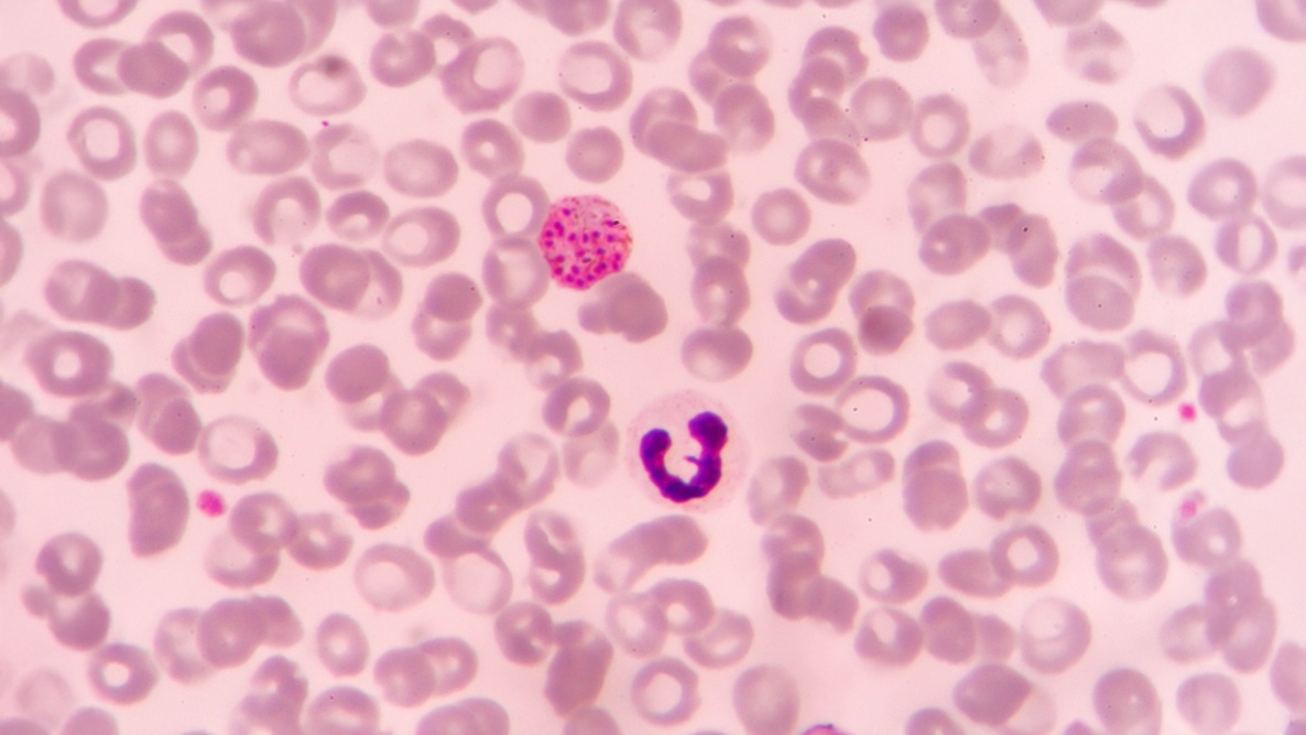 Imagem no microscópio da malária P. vivax