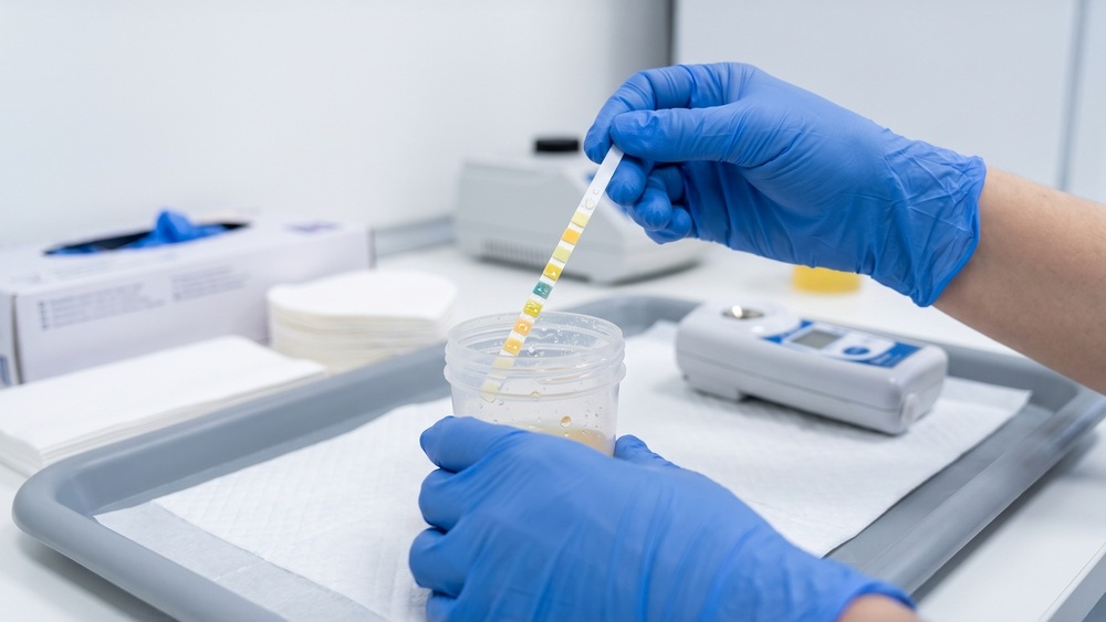 Profissional de laboratório manipulando uma amostra de urina